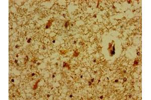 Immunohistochemistry of paraffin-embedded human brain tissue using ABIN7159217 at dilution of 1:100 (MC5 Receptor 抗体  (AA 1-37))