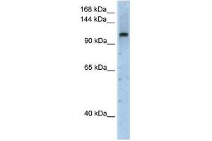 WB Suggested Anti-PRPF6 Antibody Titration:  2. (PRP6/ANT-1 抗体  (N-Term))