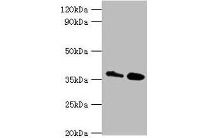 Western blot All lanes: CTSK antibody at 8 μg/mL Lane 1: MCF-7 whole cell lysate Lane 2: Rat brain tissue Secondary Goat polyclonal to rabbit IgG at 1/10000 dilution Predicted band size: 37 kDa Observed band size: 37 kDa