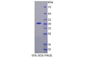 SDS-PAGE analysis of Mouse CASQ Protein. (Calsequestrin 蛋白)