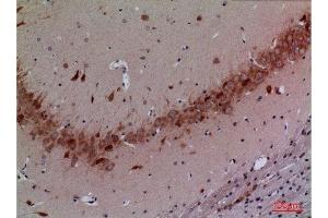 Immunohistochemistry (IHC) analysis of paraffin-embedded Rat Brain, antibody was diluted at 1:100. (Cullin 4B 抗体  (Internal Region))