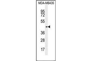 Western blot analysis of OR2L13 Antibody (C-term) in MDA-MB435 cell line lysates (35ug/lane). (OR2L13 抗体  (C-Term))
