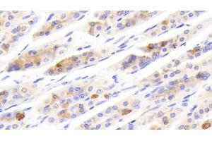 Detection of SCGN in Mouse Stomach Tissue using Polyclonal Antibody to Secretagogin (SCGN) (SCGN 抗体  (AA 1-276))