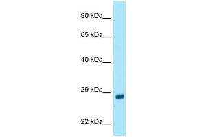 WB Suggested Anti-RAB4A Antibody Titration: 1. (Rab4 抗体  (C-Term))