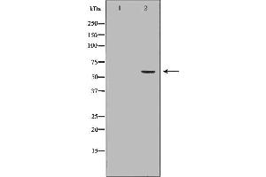 Western blot analysis of Hela whole cell lysates, using BMPR1A Antibody. (BMPR1A 抗体  (N-Term))