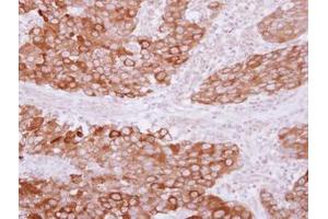 Image no. 1 for anti-Phosphotidylinositol Transfer Protein, beta (PITPNB) (AA 1-266) antibody (ABIN1500227) (PITPNB 抗体  (AA 1-266))