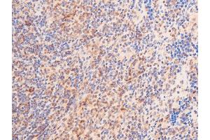 ABIN6267288 at 1/100 staining rat spleen tissue sections by IHC-P. (p53 抗体  (pSer392))