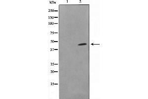 Western blot analysis on COLO205 cell lysate using DOK6 Antibody，The lane on the left is treated with the antigen-specific peptide. (DOK6 抗体  (Internal Region))