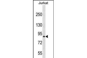 CUL4A Antibody (N-term) (ABIN657794 and ABIN2846767) western blot analysis in Jurkat cell line lysates (35 μg/lane). (Cullin 4A 抗体  (N-Term))