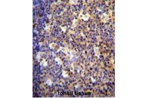 Immunohistochemistry (Paraffin-embedded Sections) (IHC (p)) image for anti-Arachidonate 12-Lipoxygenase, 12R Type (ALOX12B) (AA 629-660), (C-Term) antibody (ABIN950354)