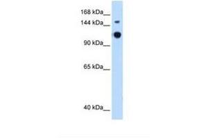 GAPVD1 抗体  (AA 182-231)
