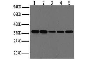 Western Blot analysis of Hela, Rat brain, Rabbit muscle, Sheep muscle, Mouse brain using GAPDH Monoclonal Antibody at dilution of 1:1000. (GAPDH 抗体)