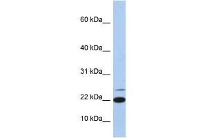 WB Suggested Anti-IL4 Antibody Titration: 0. (IL-4 抗体  (Middle Region))