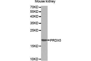 Western Blotting (WB) image for anti-Peroxiredoxin 5 (PRDX5) (AA 53-214) antibody (ABIN1682285) (Peroxiredoxin 5 抗体  (AA 53-214))