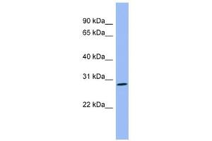 Growth Hormone 2 antibody used at 1 ug/ml to detect target protein.