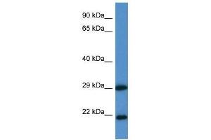 Western Blot showing CLIC3 antibody used at a concentration of 1. (CLIC3 抗体  (N-Term))