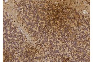 ABIN6274479 at 1/100 staining Rat brain tissue by IHC-P. (IP6K3 抗体  (Internal Region))