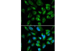 Immunofluorescence (IF) image for anti-Killer Cell Immunoglobulin-Like Receptor, Two Domains, Long Cytoplasmic Tail, 3 (KIR2DL3) (AA 22-245) antibody (ABIN3022411)