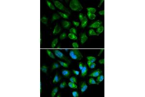 Immunofluorescence analysis of HepG2 cell using KIR2DL3 antibody. (KIR2DL3 抗体  (AA 22-245))