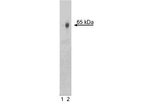 Western blot analysis of NF-kappaB p65 (pS529) in human peripheral blood mononuclear cells (PBMC). (NFkB 抗体  (pSer529))