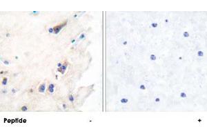Immunohistochemical analysis of paraffin-embedded human brain tissue using PLCB3 polyclonal antibody . (PLCB3 抗体  (Ser1105))