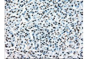 Immunohistochemical staining of paraffin-embedded colon tissue using anti-MAP2K4mouse monoclonal antibody. (MAP2K4 抗体)