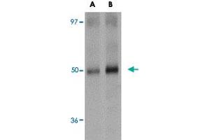 Western blot analysis of SQSTM1 in human spleen tissue lysate with SQSTM1 polyclonal antibody  at (A) 1 and (B) 2 ug/mL . (SQSTM1 抗体  (C-Term))