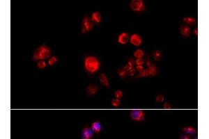 Immunofluorescence analysis of HeLa cells using GLUD2 Polyclonal Antibody at dilution of 1:100 (40x lens). (GLUD2 抗体)
