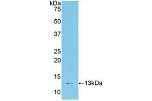 Detection of Recombinant TCF20, Mouse using Polyclonal Antibody to Transcription factor 20 (TCF20) (TCF20 抗体  (AA 1871-1965))