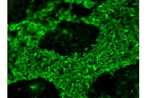 Image no. 1 for anti-Vimentin (VIM) antibody (ABIN335381) (Vimentin 抗体)