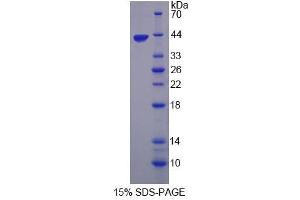 Image no. 1 for Tropomodulin 3 (TMOD3) (AA 1-352) protein (His tag) (ABIN6237179) (TMOD3 Protein (AA 1-352) (His tag))