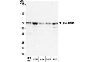 Western Blotting (WB) image for anti-GATA Zinc Finger Domain Containing 2A (GATAD2A) (AA 573-633) antibody (ABIN7454824) (GATAD2A 抗体  (AA 573-633))