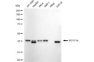 Western blotting analysis using PCYT1A antibody (ABIN7799789). (Recombinant PCYT1A 抗体)