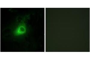 Immunofluorescence (IF) image for anti-G Protein-Coupled Receptor Kinase 6 (GRK6) (AA 10-59) antibody (ABIN2889479) (GRK6 抗体  (AA 10-59))