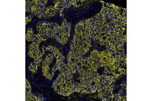 Immunofluorescence (IF) image for anti-Cadherin 1, Type 1, E-Cadherin (Epithelial) (CDH1) (AA 155-707) antibody (ABIN7455206)