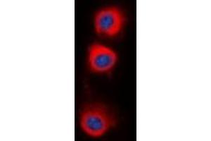 Immunofluorescent analysis of PPP2CA staining in HepG2 cells. (PPP2CA 抗体  (C-Term))
