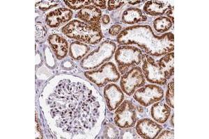 Immunohistochemical staining of human kidney with HISPPD1 polyclonal antibody  shows strong cytoplasmic positivity in cells in tubules while strong nuclear positivity in cells in glomeruli at 1:200-1:500 dilution. (HISPPD1 抗体)