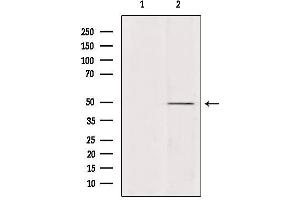 Western blot analysis of extracts from various samples, using ATP6V1C2 Antibody. (ATP6V1C2 抗体  (Internal Region))