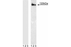 Western blot analysis of c-Cbl (pY774) in human T leukemia. (CBL 抗体  (pTyr774))