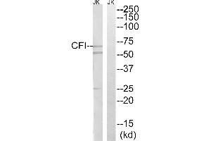 Western blot analysis of extracts from Jurkat cells, using CFI antibody. (Complement Factor I 抗体)