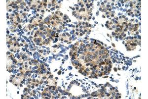 ZNF555 antibody was used for immunohistochemistry at a concentration of 4-8 ug/ml to stain Epithelial cells of pancreatic acinus (arrows) in Human Pancreas. (ZNF555 抗体  (N-Term))