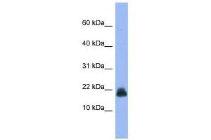 Western Blot showing Cst6 antibody used at a concentration of 1-2 ug/ml to detect its target protein. (CST6 抗体  (Middle Region))