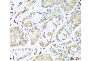 Immunohistochemistry of paraffin-embedded Human stomach using RPH3AL Polyclonal Antibody at dilution of 1:100 (40x lens). (RPH3AL 抗体)
