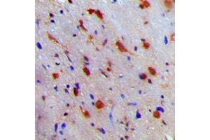 Immunohistochemical analysis of NEURL1 staining in human brain formalin fixed paraffin embedded tissue section. (NEURL 抗体  (Center))