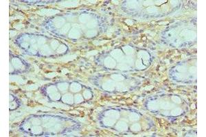 Immunohistochemistry of paraffin-embedded human epityphlon tissue using ABIN7171057 at dilution of 1:100 (SMARCC2 抗体  (AA 300-650))