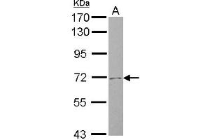 Western Blotting (WB) image for anti-Solute Carrier Family 4, Sodium Bicarbonate Cotransporter, Member 8 (SLC4A8) (N-Term) antibody (ABIN1494094) (SLC4A8 抗体  (N-Term))