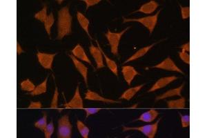 Immunofluorescence analysis of L929 cells using GLB1 Polyclonal Antibody at dilution of 1:100. (GLB1 抗体)