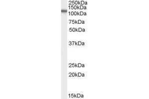 ABIN190918 (2µg/ml) staining of human spleen lysate (35µg protein in RIPA buffer). (OSBPL5 抗体  (N-Term))