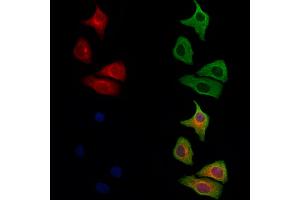 ABIN6264553 and ABIN6279706 staining Hela cells by IF/ICC.
