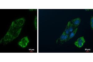 ICC/IF Image PCK2 antibody [C1C2], Internal detects PCK2 protein at mitochondria by immunofluorescent analysis. (PEPCK 抗体)
